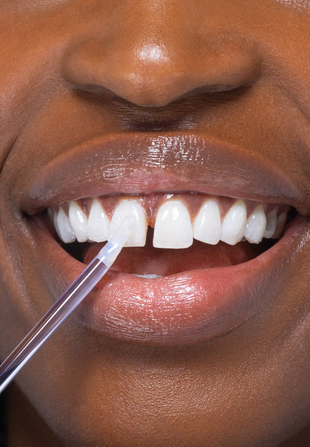 The $29 'magic' teeth whitening powder from HiSmile that works in